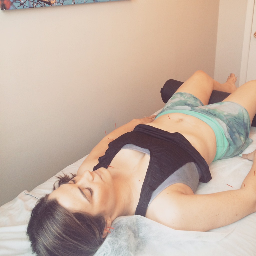 acupuncture atelier hoboken girl