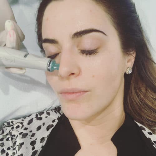 nj-acupuncture-hydrafacial