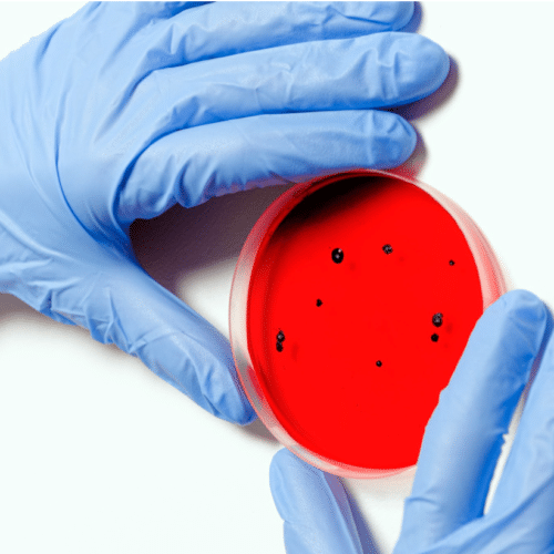 restaurant germs safety hoboken jersey city