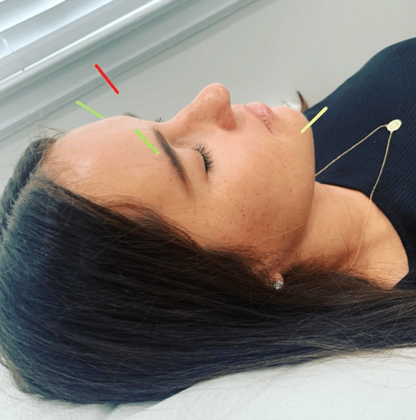 acupuncture businesses hoboken jersey city