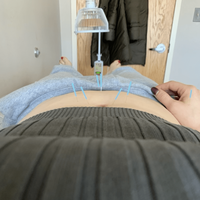 nj acupuncture