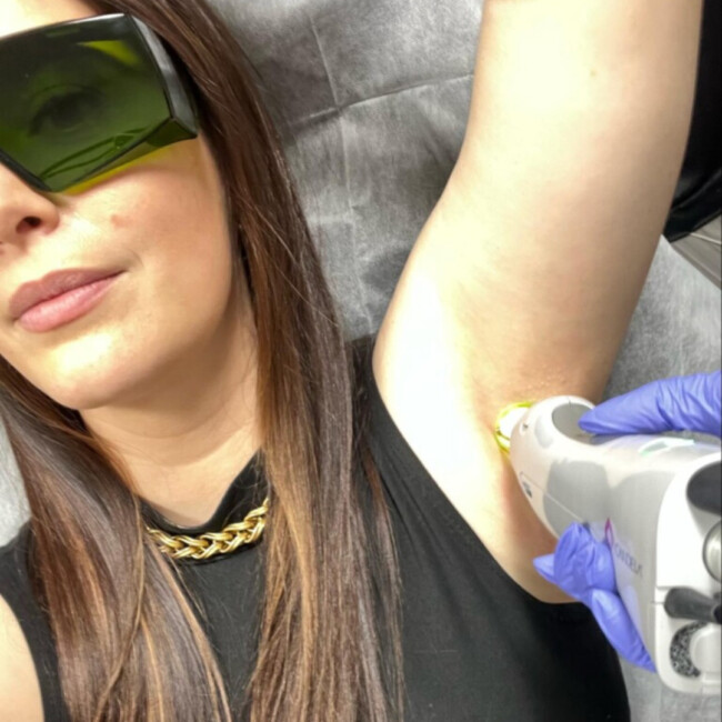 Laser hair removal treatment with woman wearing sunglasses, black shirt, and necklace