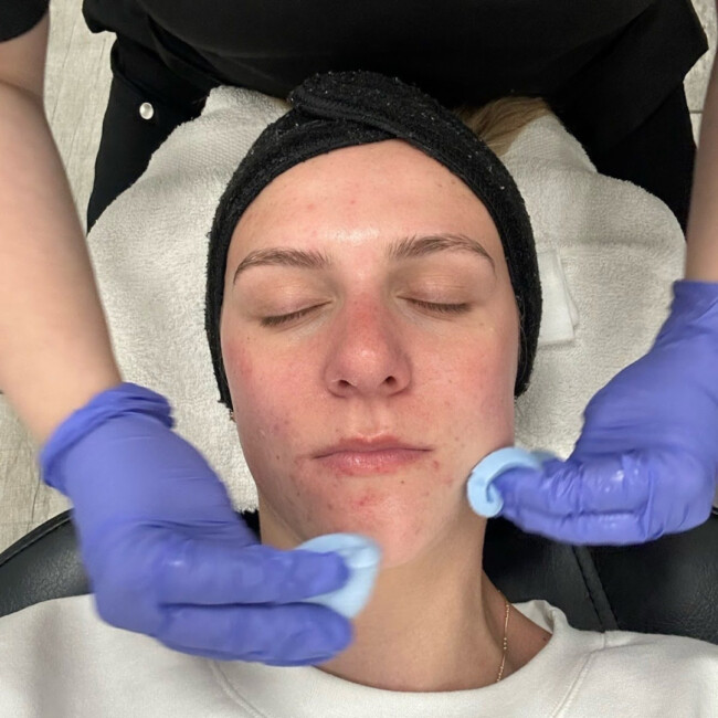 Woman getting facial treatment at Evolve Med Spa 